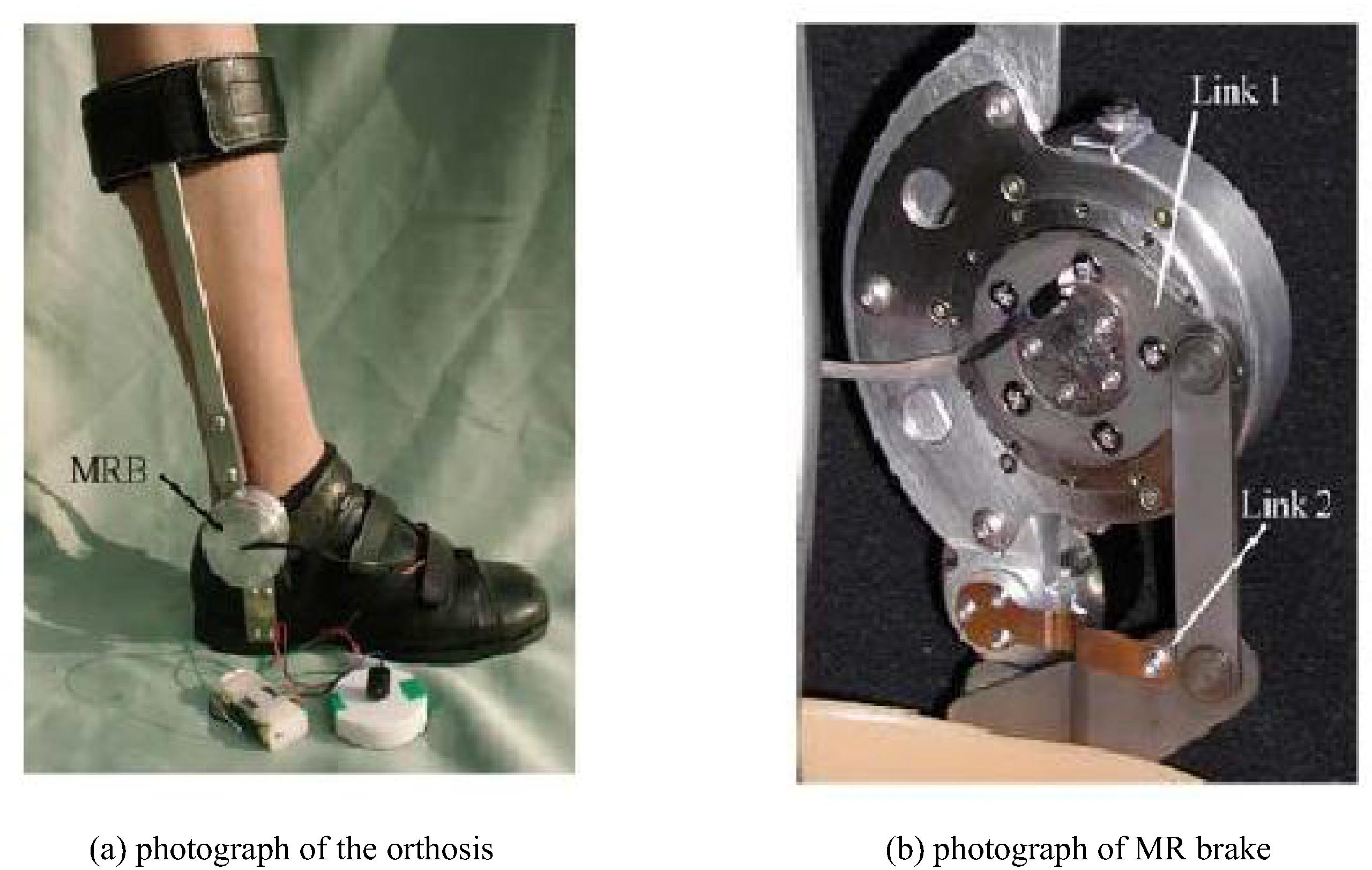 An ankle-foot orthosis using MR brake (Furusho et al., 2007).