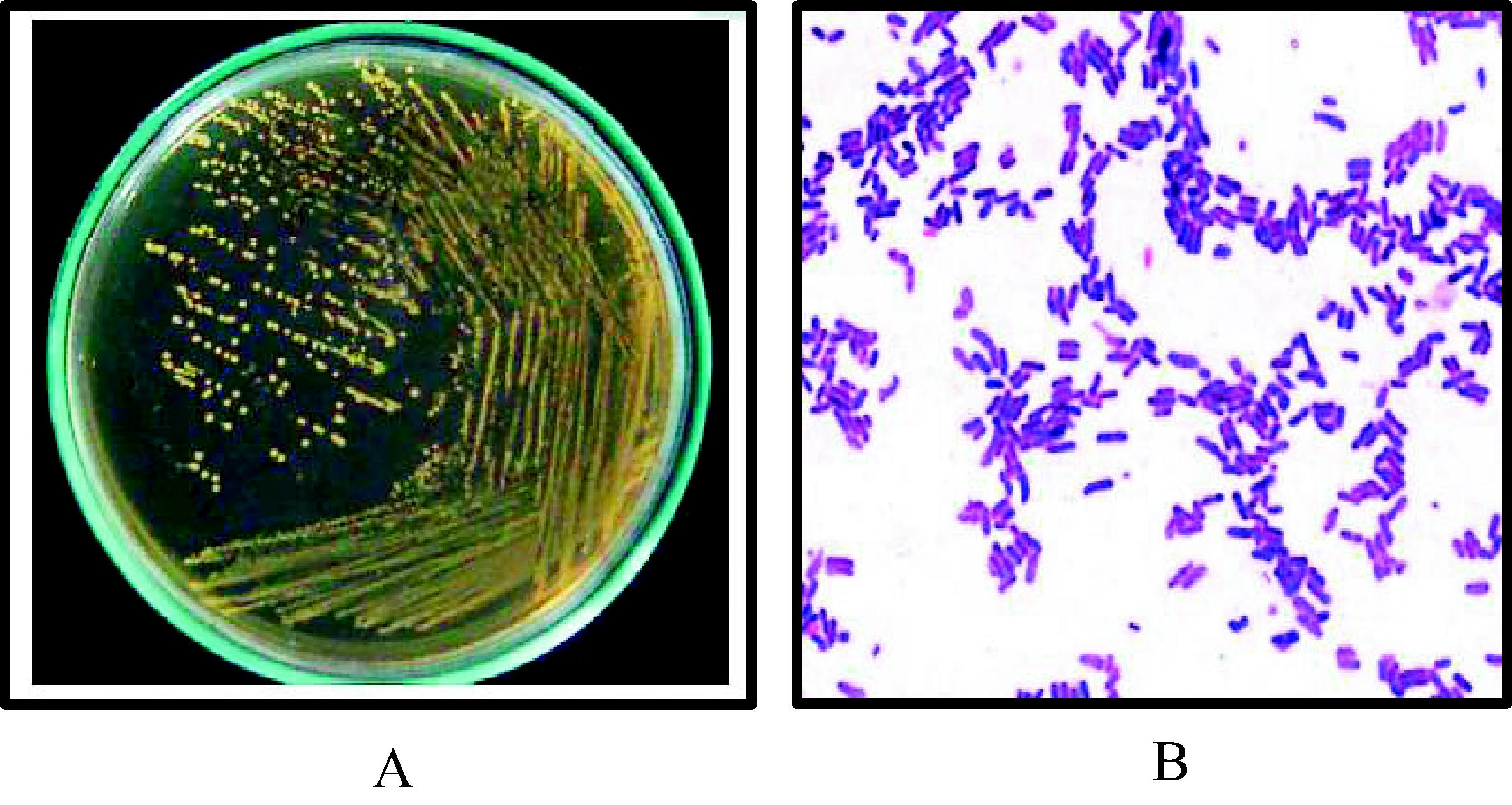 Morphological and microscopic properties of Lactobacillus mixtures. (A) Lactobacillus on MRS agar medium, 37 °C, 48 h, and anaerobic condition. (B) Lactobacillus stained with gram stain under light microscope (X1000).