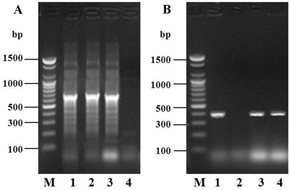 Electrophoretic analysis of PCR-amplified target genes from Vibrio sp. and C. butyricum obtained under optimal conditions of PCR of isolates following biochemical test. Mobilities of the different target genes are indicated on the right. (A) Lane M, 100-bp DNA ladder (size marker); lane 1–4, isolates of Vibrio sp. (B) Lane M, 100-bp DNA ladder (size marker); lane 1–4, isolates of C. butyricum.