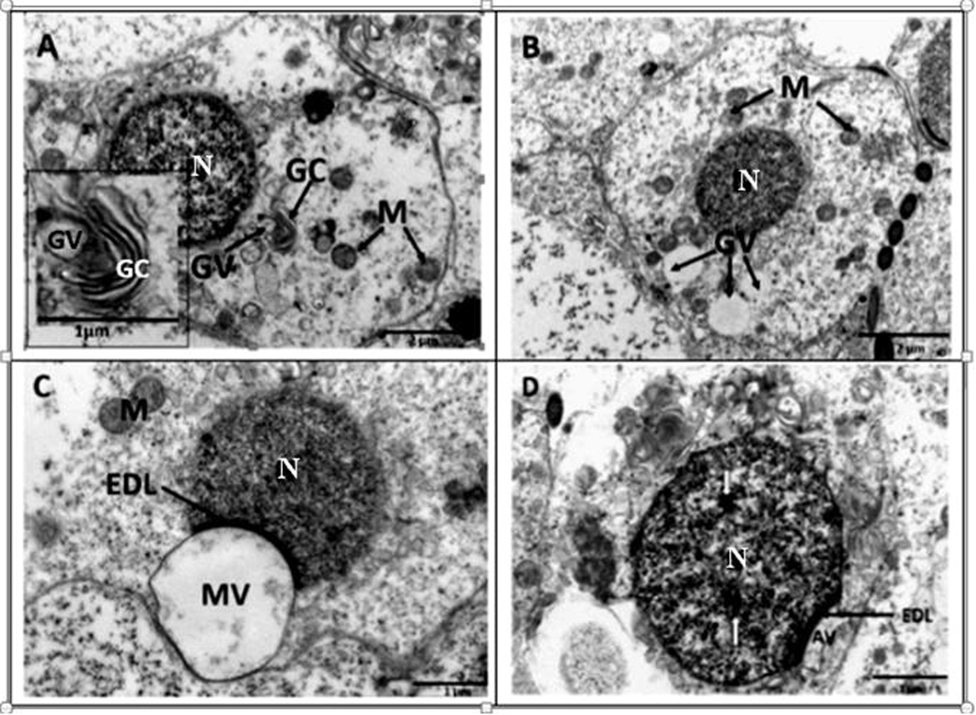 Transmission electron microscope photomicrographs of round spermatids in the African sideneck turtle. A. Observe the prominent Golgi complex (GC) with budding vesicles (GV); N: nucleus; M: mitochondria. Inset: Golgi complex with budding vesicle. B. Round spermatid with conspicous Golgi vesicles (GV) of various sizes which later coalesce to form a macrovesicle. Mitochondria (M) are evenly distributed around the nucleus (N). C. A macrovesicle (MV) formed as a result of coalescence of small vesicles attached to the nuclear membrane of a round spermatid. An electron dense layer (EDL) is formed at the point of attachment between the nucleus (N) and macrovesicle. Justanuclear mitochondria (M) are also present. D. Round spermatid subsequent to the flattening of the proacrosomal vesicle, resulting in the formation of the acrosomal vesicle (AV). The electron dense layer (EDL) still intact, while the nucleus (N) shows sparse areas of deep staining chromatin (white arrows).