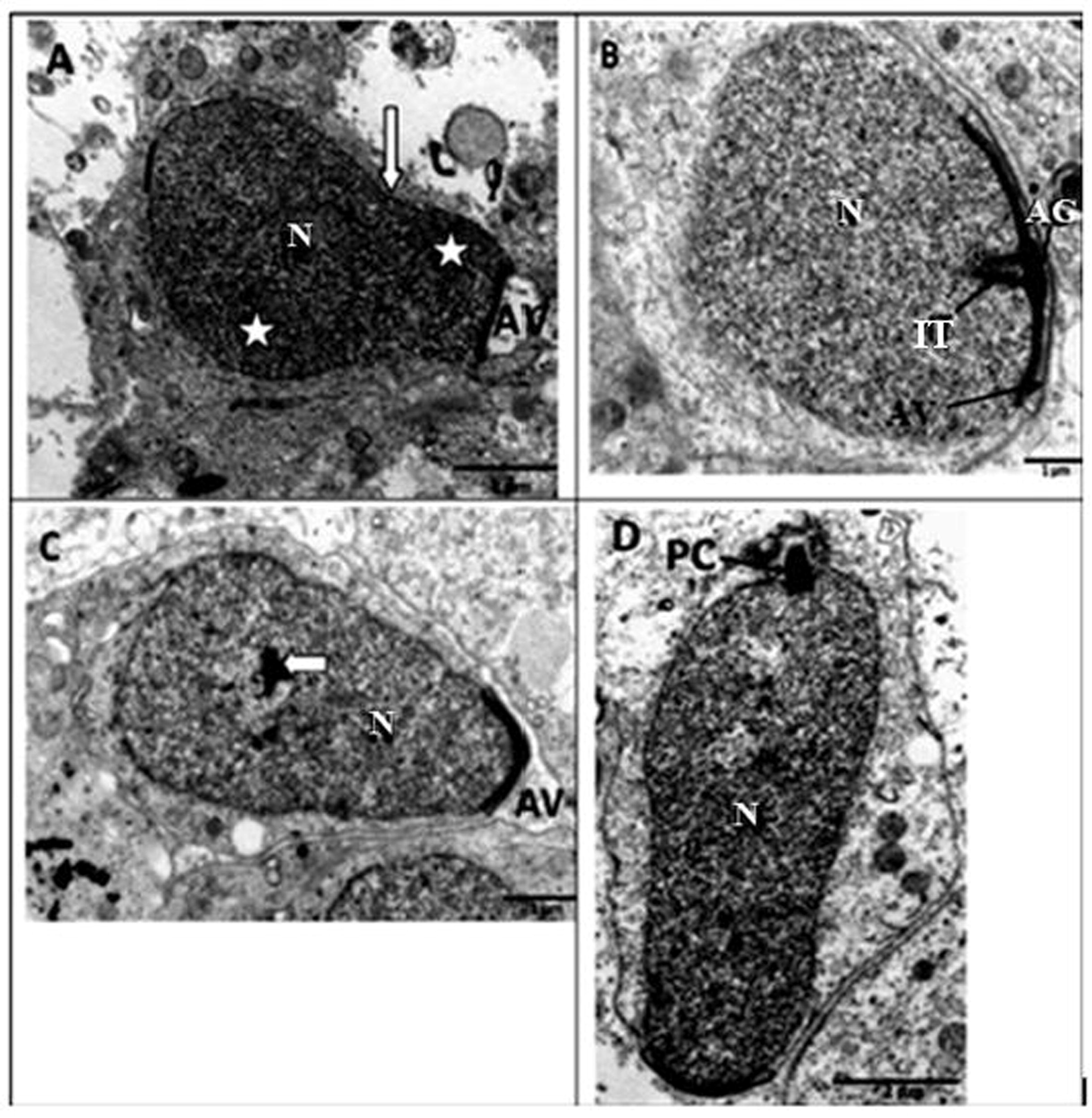 Transmission electron microscope photomicrographs of late round and elongating spermatids in the African sideneck turtle. A. Late round spermatid, N: nucleus; AV: acrosomal vesicle. Note the point of nuclear elongation (white arrow) and condensation (asterisks). B. Early stage in the formation of an elongating spermatid. AG: acrosome granule; AV: Acrosomal vesicle; two parallel intranuclear tubules (IT) have formed in the interior of the nucleus (N). C. Elongating spermatid showing centrally-placed nuclear chromatin (white arrow) within the nucleus (N). Note the streamlined acrosomal vesicle (AV) assuming a pointed shape. D. Elongating spermatid with the proximal centriole (PC) at the caudal end of the nucleus (N). Note that the nuclear chromatin is distributed as a heterongenous mass.