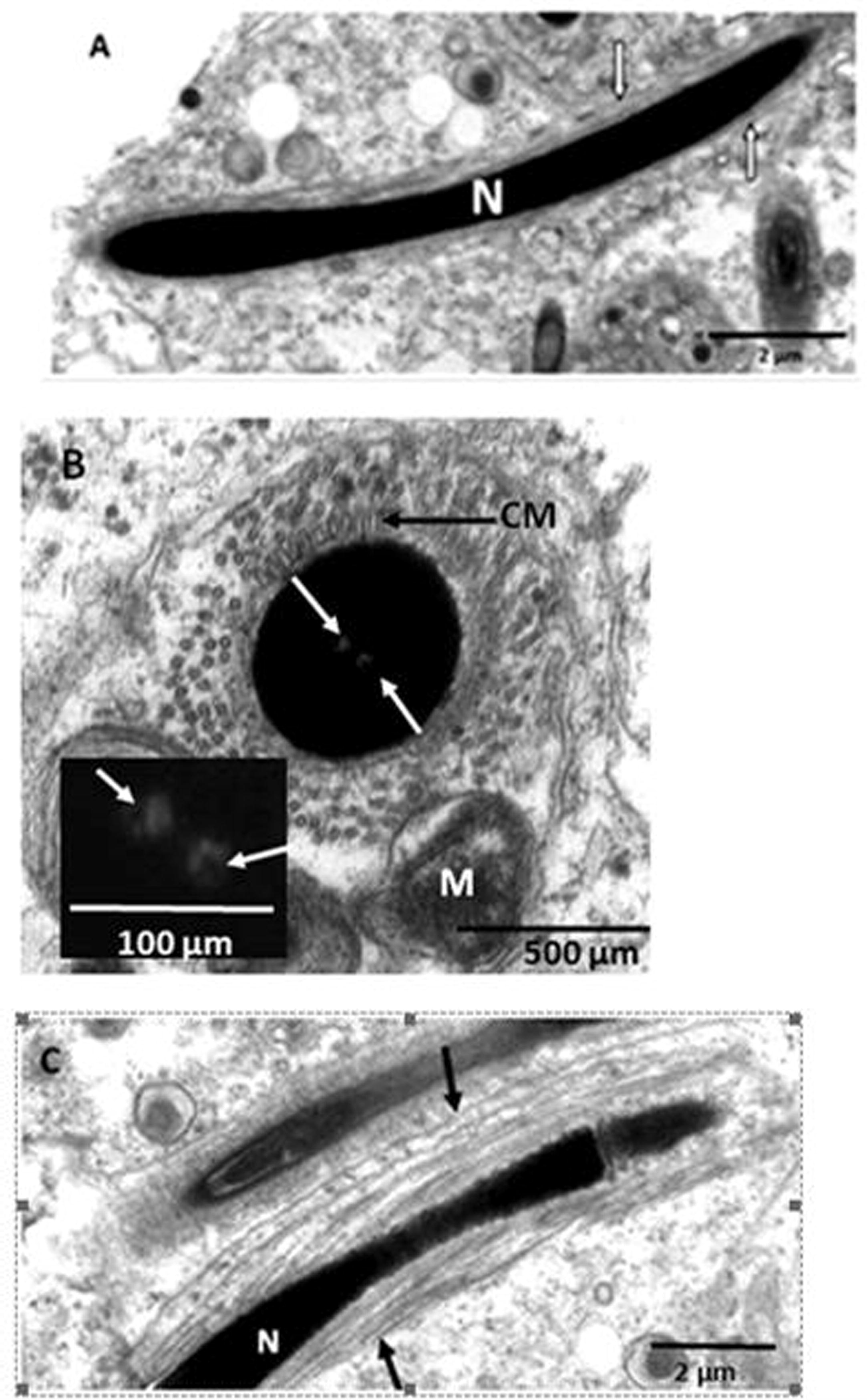 Transmission electron microscope photomicrographs of elongating spermatids in the African sideneck turtle. A. Longitudinal section of an elongating spermatid. Longitudinal microtubules of the manchette (white arrows) surround the nucleus (N). B. Cross section of an elongating spermatid showing circular microtubules of the manchette (CM) surrounding the nucleus. The microtubules are partially surrounded by mitochondria while the nucleus bears endonuclear canals (white arrows). Inset: endonuclear canals (white arrows). Note that the circular microtubules of the manchette are thicker than the longitudinal type shown in Fig. 4A. C. Longitudinal section of an elongating spermatid. Slanting microtubules of the manchette (black arrows) surround the nucleus (N).