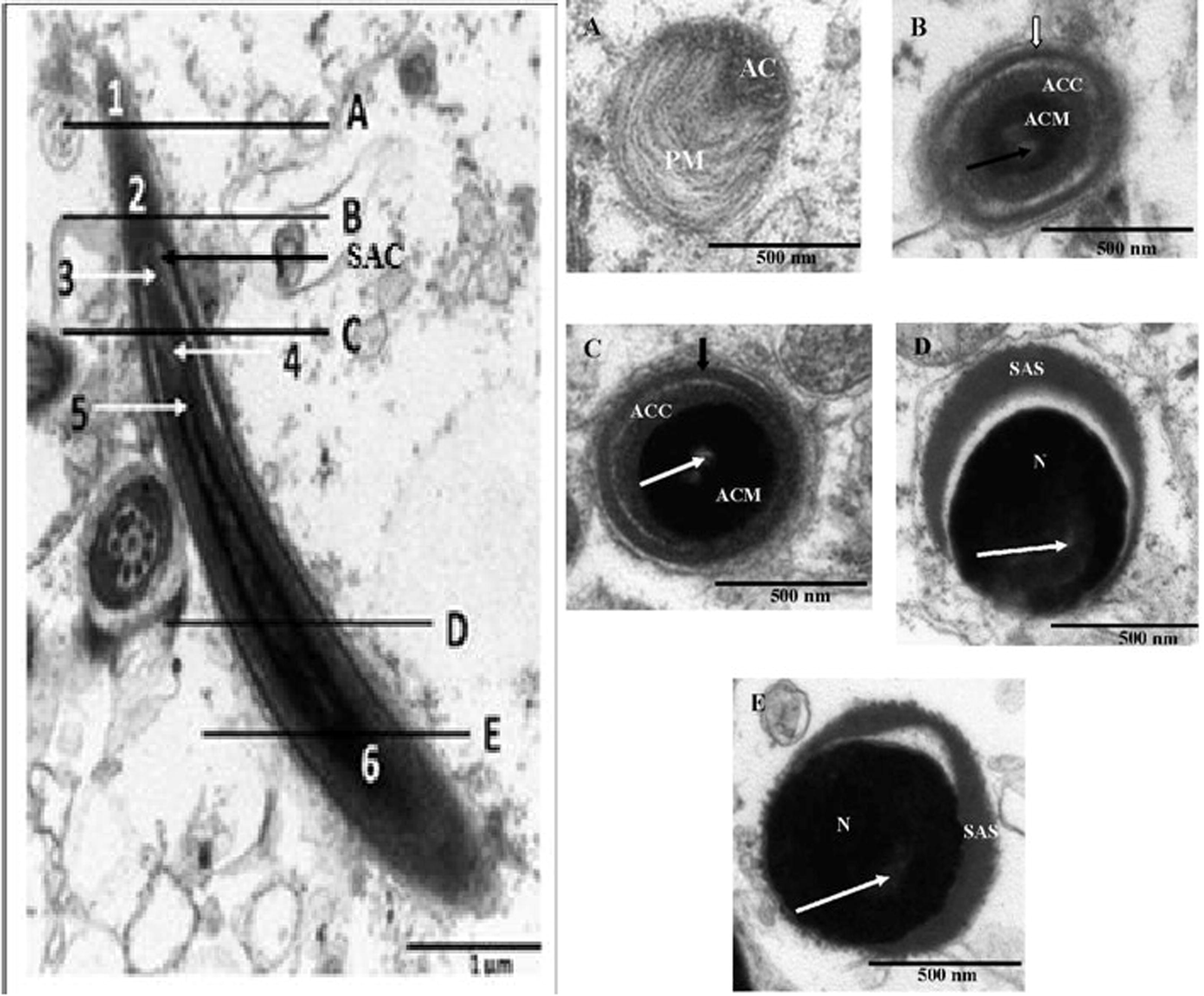 Left: Transmission electron microscope photomicrographs of the longitudinal view of the acrosmal complex in the African sideneck turtle. 1: Plasma membrane of acrosome; 2: Acrosome; 3: Subacrosomal space; 4: Electron lucent endonuclear canal; 5: Nuclear tip; 6: Nucleus; SAC: Sub-acrosomal cone. Right: Cross sectional views of serial sections of the acrosome complex in the African sideneck turtle. A. Cross sectional view of the acrosmal complex sectioned at A (level of the plasma membrane just cranial to the acrosome). AC: Acrosome. PM: Plasma membrane. B. Cross sectional view of the acrosomal complex sectioned at B (level of the acrosome). ACC: Acrosome cortex. ACM: Acrosome medulla. White arrow: Acrosomal cap. Black arrow: Electron lucent endonuclear canal. C. Cross sectional view of the acrosomal complex sectioned at C (level of the subacrosome). ACC: Acrosome cortex. ACM: Acrosome medulla. Black arrow: Acrosomal cap. White arrow: Electron lucent endonuclear canal. D. Cross sectional view of the acrosomal complex sectioned at D (mid level of nucleus). SAS: Subacrosomal space. N: Nucleus. White arrow: Electron lucent endonuclear canal. E. Cross sectional view of the acrosomal complex sectioned at E (level of the base of nucleus). SAS: Subacrosomal space. N: Nucleus. White arrow: Electron lucent endonuclear space.