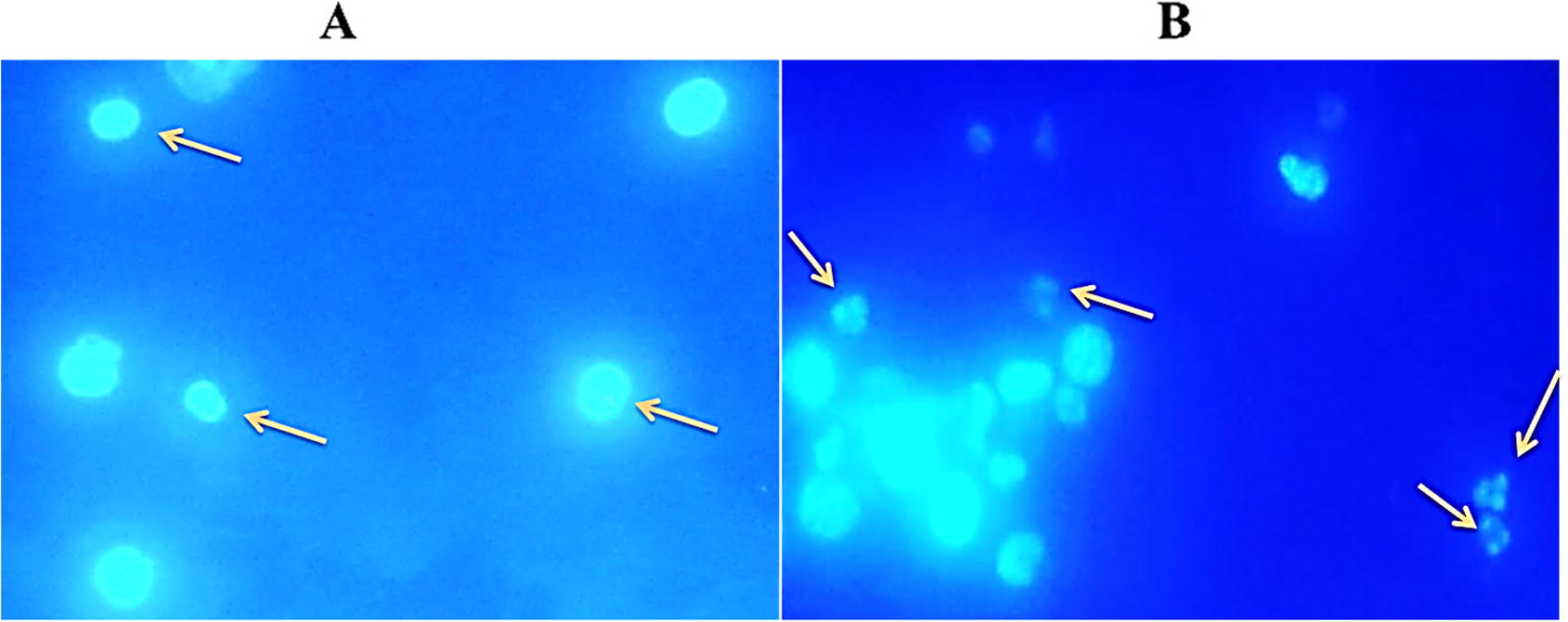 MEKGR induced apoptosis is in Ehrlich ascites carcinoma (EAC) cell. EAC cells were treated for 24 h then cells were collected from the treated and non-treated EAC-bearing mice and stained with Hoechst 33342 and observed by fluorescence microscopy. Left panel (A) indicates control and right panel (B) indicates MEKGR (10 mg/kg/day) noted that apoptotic characteristics e.g. nuclear condensation and fragmentation are seen in figure B.