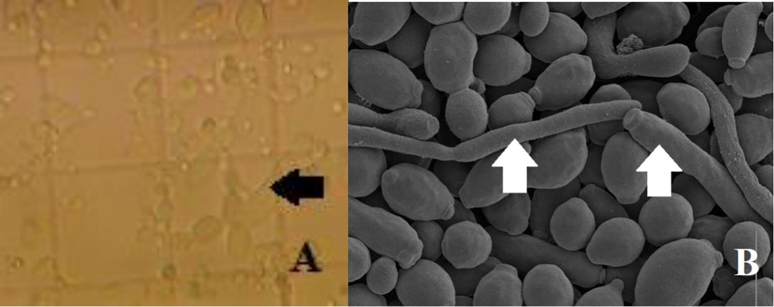 Microscopic observation of: (A) optical microscope after vortexing samples for one minute, (B) scanning electron microscope. Arrows indicate hyphae and pseudohyphs (Magnification, A: ×400, B: ×5000).