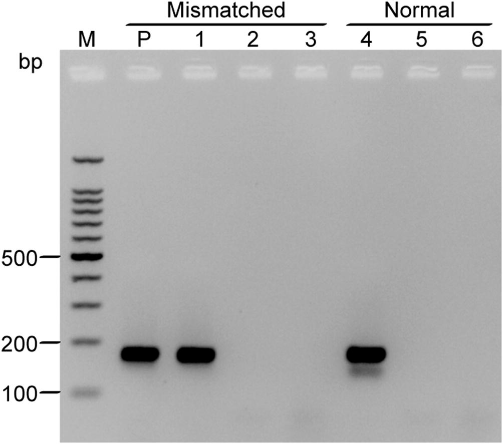 RT-PCR amplification of GAPDH171 fragment from H. salicornicum using total RNA extracted from leaf-stem tissues. cDNA was primed with either the primer pair S1/S2 that contains single mismatch near the 3′ region or with the normal primer pair S1/S4 that contains no mismatch. Total RNA extracted from leaf tissues of Red Beet was included as positive control (P). Lanes 1 and 4 are total RNA from H. salicornicum treated with DNase I prior subjecting to reverse transcriptase reaction. Lanes 2 and 5 are non-template controls (NTC). Lanes 3 and 6 are reverse transcriptase controls (RTC). Both primer pairs resulted in an amplicon with a size of 171 bp. PCR products were analyzed by electrophoresis in 2% agarose gel and visualized by ethidium bromide staining. Each lane was loaded with 5 µl of the PCR reaction. M: 100 bp DNA ladder (ThermoFisher Scientific); bp: base pair.