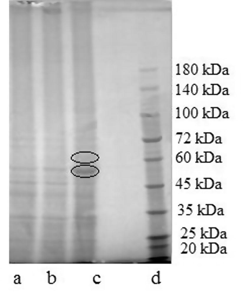 Gel obtained from SDS-PAGE of protein cells under the effect of: (a) control; (b) extract; (c) fiber-free extract; (d) proteins marker.