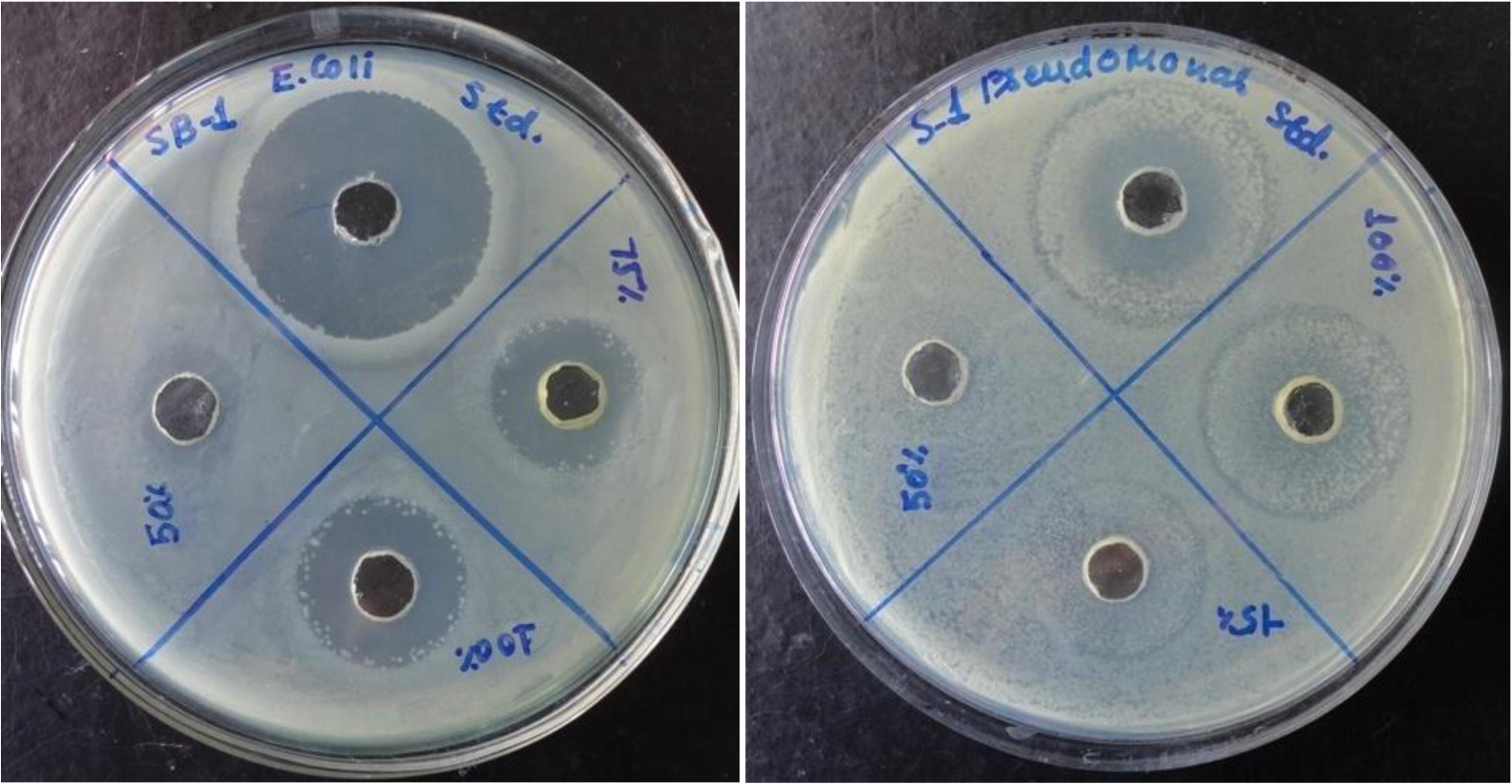 Petri-dishes showing inhibition zones.