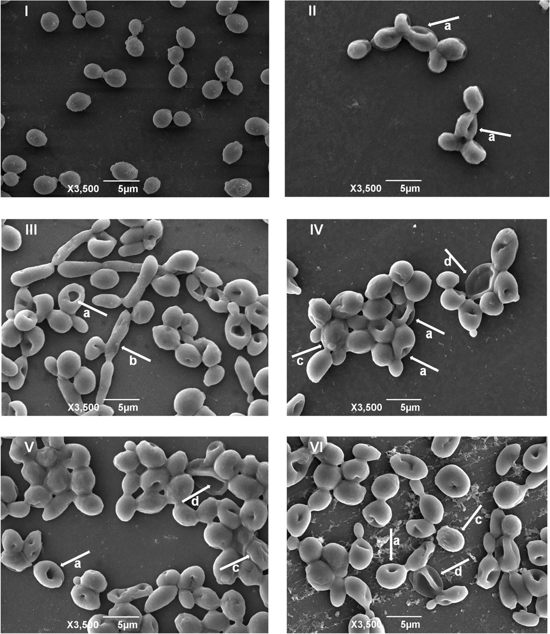 Electron micrographs of Candida albicans ATCC 10,231 not subjected to pharmacological treatment and submitted to treatment with the resveratrol analogs and the reference drug. I: C. albicans not subjected to pharmacological treatment. II: C. albicans subjected to treatment with amphotericin B. III: C. albicans subjected to treatment with analog A. IV: C. albicans subjected to treatment with analog B. V: C. albicans subjected to treatment with analog C. VI: C. albicans subjected to treatment with analog D. a: invaginations in the plasma membrane. b: pseudo-hyphae. c: irregular plasma membrane. d: leakage of intracellular material.