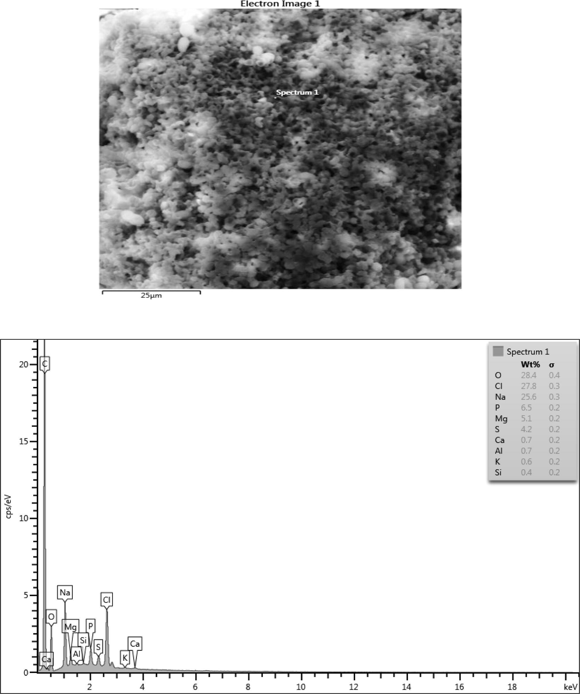 Microstructure, surface morphology and chemical composition of PHA from Rhodococcus species.