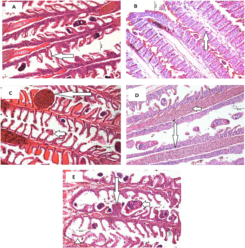 Photomicrographs of the gill of Panga-like Clariothalmus. (a) epithelial lifting; (b) Complete hyperplasia of the secondary lamellae (arrow); (c) aneurisms in secondary lamellae (long arrow), Telangiectasis at the secondary lamellae (short arrow); (d) blood congestion in primary lamellae (short arrow), complete fusion of several lamellae. (e) fusion of 3 lamellae (long arrow), ecto-parasite in the gills (short arrow), secondary lamellae disorganization (arrow head). Scale bar 50 µm. Hematoxylin/Eosin stain.
