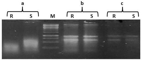 DNA contamination removal strategies using a) 5 M LiCl; b) DNase and c) acidic phenol (pH 4); M = 100 bp ladder, R = root sample, S = shoot sample.