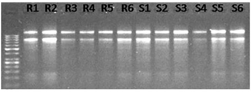 RNA extraction acidic Phenol: chloroform from root [R1–R3 (control), R4–R6 (wilt infected)] and shoot [S1–S3 (control), S4–S6 (wilt infected)] samples in three replications.