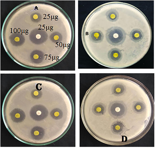 (A-D). Antibacterial activity of CuO NPs: Zone of inhibition of (A) Escherichia coli (B) Pseudomonas aeruginosa (C) Staphylooccus aureus and (D) bacillus subtilis.