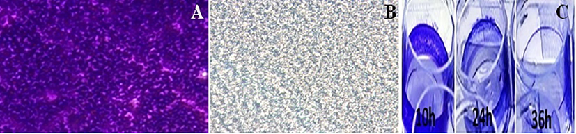 Biofilm formation in 96-well polystyrene plate wells in the absence (A) and presence (B) of biosurfactant at (500 µg/ml) after 7 days of incubation are shown (C) The microtiter plate showing decrease of biofilm with crystal violet staining.