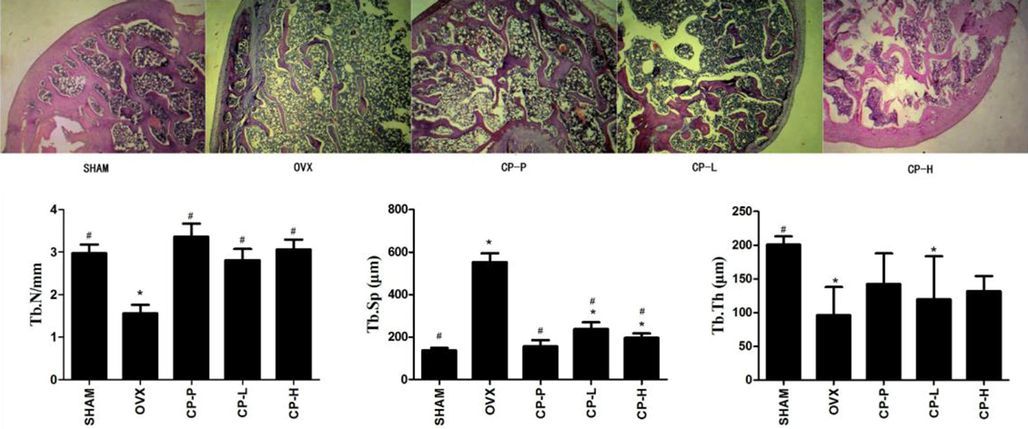 Representative images of H&E staining (4× magnification) and histomorphometric analyses of the right tibias of 35-week-old ovariectomized rats treated with low concentration CP (CP-L), high concentration CP (CP-H) or pretreated with CP (CP-P). The experiments were repeated three times. Data are expressed as means ± SD. *p < 0.05, vs SHAM group, #p < 0.05, vs. OVX group.