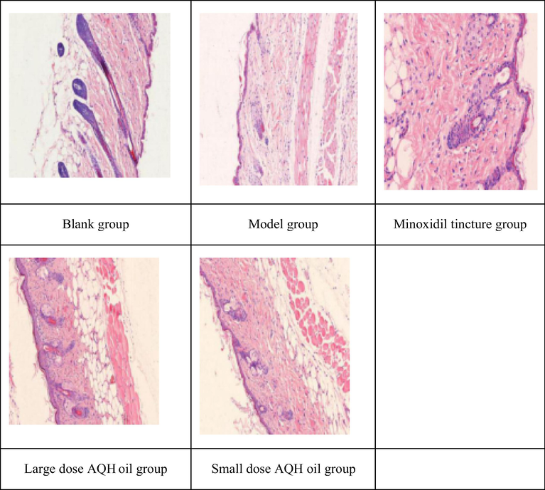 Effects of AQH oil on skin pathology of alopecia mice induced by testosterone.