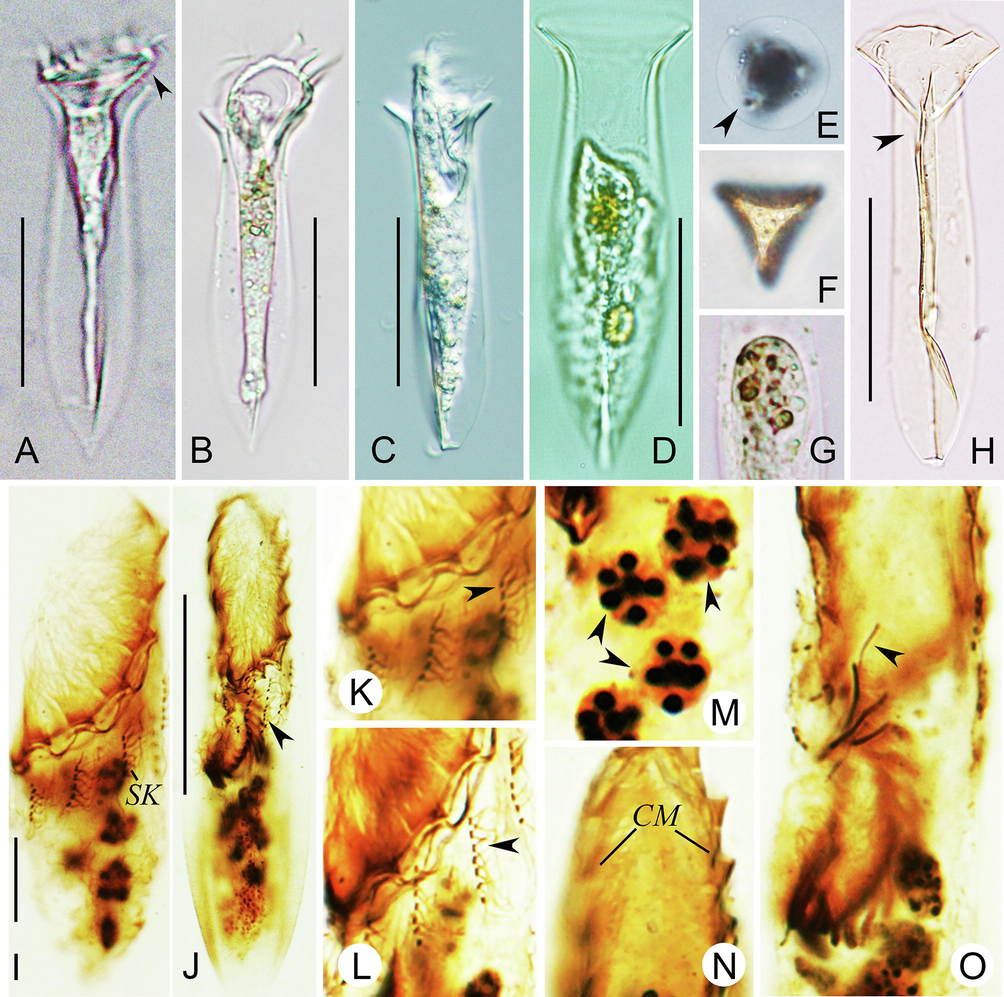 The type species of Amphorellopsis and Tintinnopsis (Protozoa ...