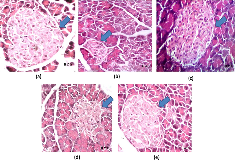 a–e: Photomicrographs of pancreas of (a) NC, (b) DC, (c) GL, (d) A. nilotica PPE (250 mg/kg), (e) A. nilotica PPE (500 mg/kg) (H&E × 40).