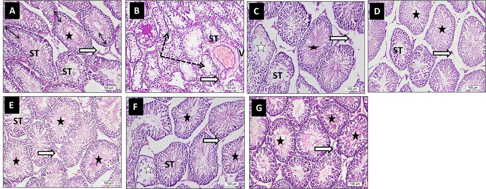 Impact of ellagic acid (EL), nano ellagic acid (NEL); and their mixture with metformin (MET) on testis histopathology investigated in high fat diet (HF)/streptozotocin (STZ)-induced diabetes model. Sections from rats testis stained by H & E (x 20 magnification). Photo A (CON) shows normal size seminiferous tubules (ST), most are of full thickness germ layers (double head arrows) with mature sperms with their tails extend to the lumina (star). Interstitial Leydig cells are of normal population (white arrow). Photo B (HF + STZ) shows marked decrease in size of ST, disorganization, degeneration, and loss of germ cells. Some tubules contain seminal fluid (dotted arrows), and congested blood vessels (V). Interstitial Leydig cells are of nearly normal population (white arrow). Photo C (HF + STZ + MET) shows potential preservation of most germ cell layers of ST with mature sperms (black star); however, few ST are of decreased thickness with absence of mature sperm (white stars). Interstitial Leydig cells are of normal population (white arrow). Photo D (HF + STZ + EL) shows better preservation of ST germ cell layers, mature sperms (black stars) and interstitial Leydig cells (white arrow) which looked more healthier than in MET photo. Photo E (HF + STZ + NEL) shows that most ST looked larger in size, with regular outlines and full thickness germ cell layers, most tubules contain mature sperms (black stars). Photo F (HF + STZ + MET + EL) and photo G (HF + STZ + MET + NEL) show the best preservation relative to their respective single treatment photos.