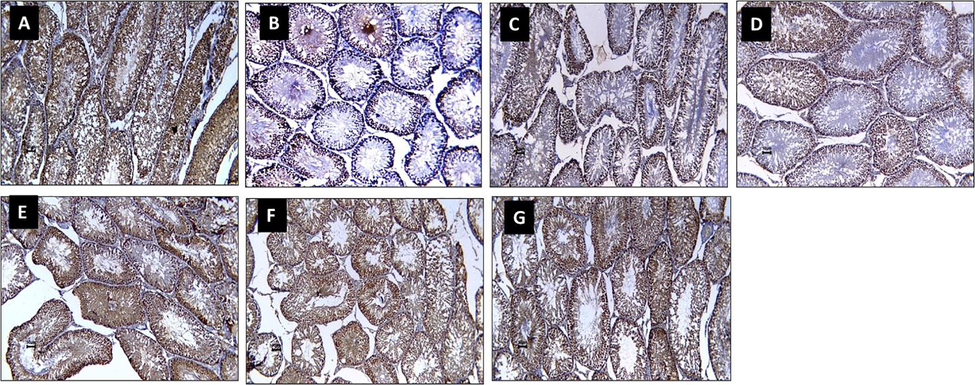 Impact of ellagic acid (EL), nano ellagic acid (NEL); and their mixture with metformin (MET) on testis PCNA protein expression investigated in high fat diet (HF)/streptozotocin (STZ)-induced diabetes model. Sections from rats testis immunohistochemically stained (x 20 magnification). Photo A (CON) shows high PCNA immunoexpression. Photo B (HF + STZ) shows decreased PCNA immunoexpression in nuclei of damaged tubules compared to CON photo. Photo C (HF + STZ + MET) and photo D (HF + STZ + EL) show preserved PCNA immunoexpression compared to HF + STZ photo. Photo E (HF + STZ + NEL), Photo F (HF + STZ + MET + EL), and photo G (HF + STZ + MET + NEL) show increased PCNA immunoexpression compared to HF + STZ, HF + STZ + MET, and HF + STZ + EL.