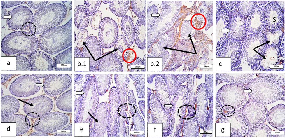 Sections of rat testis immunostained against caspase-3 (Cas-3, the apoptotic marker) and photographed at ×100 bar=200 µm showing: (a) Normal control group: with negative immunostaining for cas-3 in seminiferous tubule germ cells (white arrow) and interstitial cells (dotted black circle). (b) Diabetic group (b.1, b.2): showing higher activity of cas-3 in degenerated seminiferous tubules cells (thin black arrows) and more in the interstitial cells (red circles). (c) Metformin (Met) treated group: nearly normal cas-3 level in both seminiferous tubules (white arrow) and interstitial cells (dotted black circle), and some tubules still showed degenerated germ cells with some positive reaction (thin black arrows). (d) Ellagic acid group: moderate reduction in cas-3 activity. Interstitial cells, still, displayed positive reaction (dotted black circle). Some tubules displayed desquamated germ cells (thin black arrow). (e) Ellagic acid + Met group: showing decreased of Cas-3 activity in seminiferous tubules (white arrow), moderate level in interstitial cells (dotted circle); However, some tubules still showing degenerated cells (thin black arrow). (f) Nano-Ellagic acid group: Showing the same expression of cas-3 activity as compared to the control. Few interstitial cells still revealed positive staining of Cas-3 (circle). Nano-Ellagic acid treated group displayed the same cas-3 expression as compared to the control and few interstitial cells still revealed positive Cas-3 staining (doted circle). (g) Nano ellagic + Met group: marked improvement in cas-3 immunostaining in both seminiferous tubules (white arrow) and interstitial cells (circle).