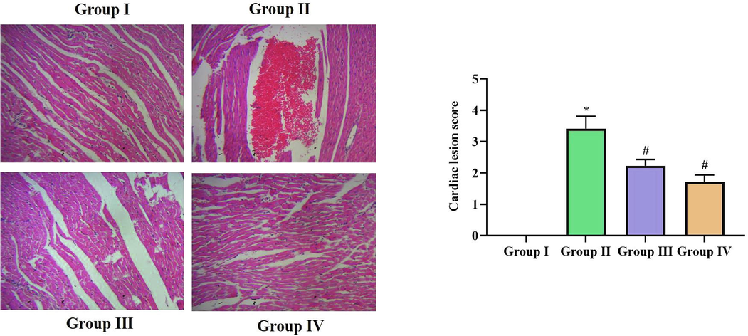 Effect of SCP-D-P nanocomposites of cardiac tissues of diabetic induced rats. Longitudinal section of H&E stained cardiac tissues of non diabetic and SCP-D-P nanocomposites treated diabetic induced rats. (Group I) Control non diabetic rats (Group II) Diabetic induced rats (Group III) Diabetic induced 5 mg/kg SCP-D-P nanocomposites treated rats (Group IV) Diabetic induced 10 mg/kg SCP-D-P nanocomposites treated rats.