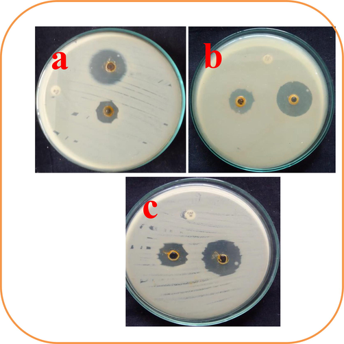 Agar well punctured method for detection of chitosan loaded essential oils against biofilm forming Acinetobacter Baumannii at concentrations of 75 μg/mL (a), 100 μg/mL (b) and 150 μg/mL (c).