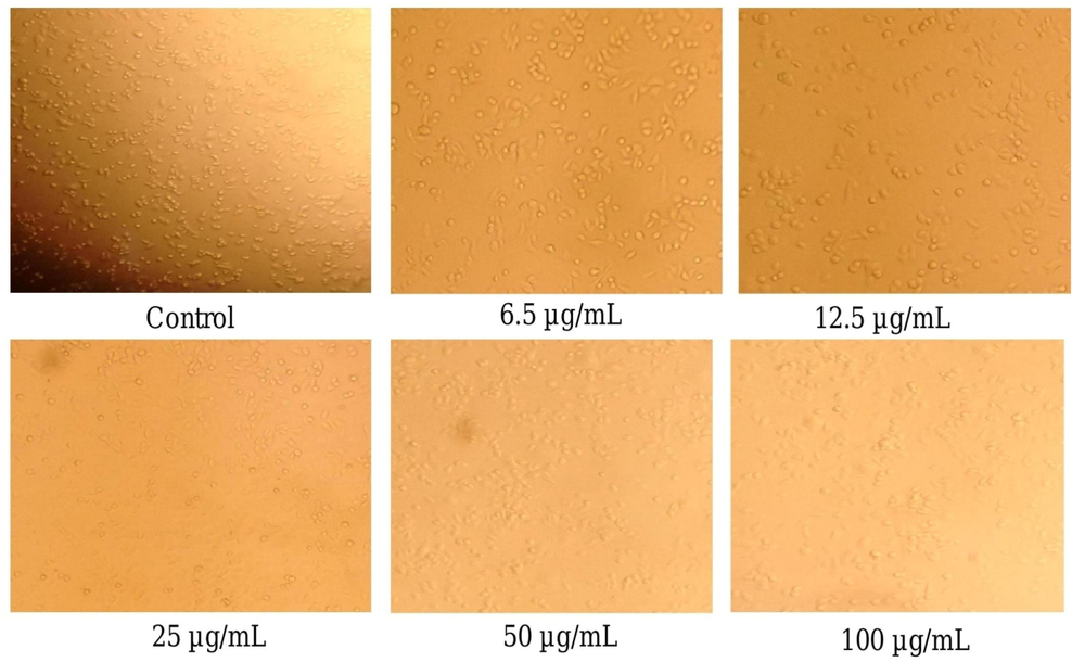 Anti-cancer observed from colon cancer cell line (HT-29) in confocal microscope (340 pixel); Control and various concentrations (6.5, 12.5, 25, 50 and 100 µg/mL) of AgNPs using P. subpeltata aqueous leaf extract (Ps-ALE).