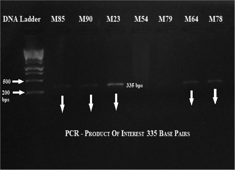 Gradient PCR thermal profile for FOXP3 gene – exon 2.