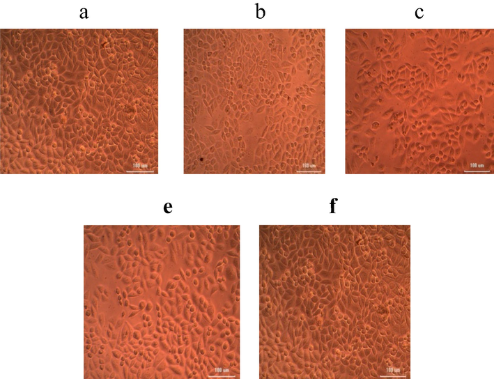 Anticancer activity of iron NPs synthesized using U. lactnca extract against HeLa cells at various concentrations of nanoparticles (a) 6.25 µg; (b) 12.5 µg; (c) 25 µg; (d) 50 µg; (e) 100 µg.