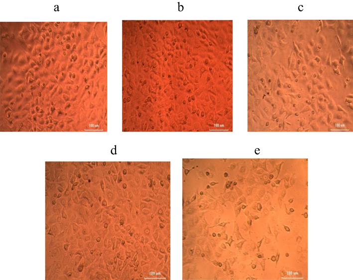 Anticancer activity of iron NPs synthesized using U. lactnca extract against DLD-1 cell lines at various concentrations of nanoparticles (a) 6.25 µg; (b) 12.5 µg; (c) 25 µg; (d) 50 µg; (e) 100 µg.