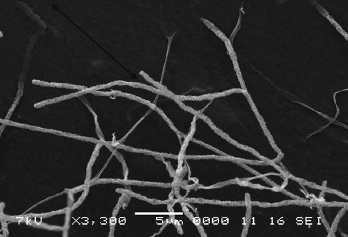 Scanning electron micrograph of the isolate EA3.