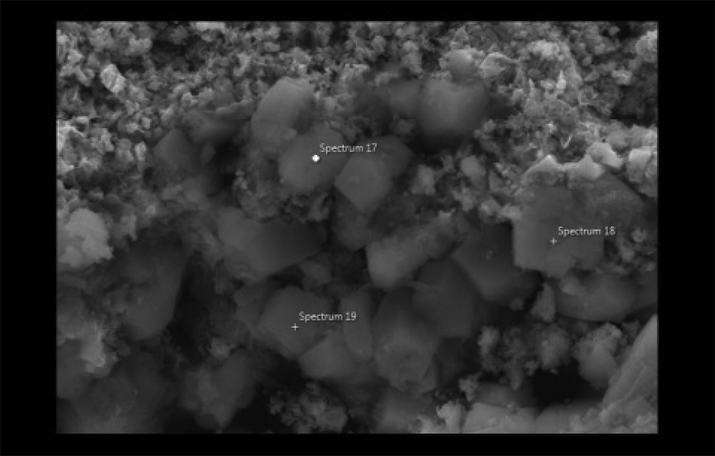 Agglomeration of calcium crystals.