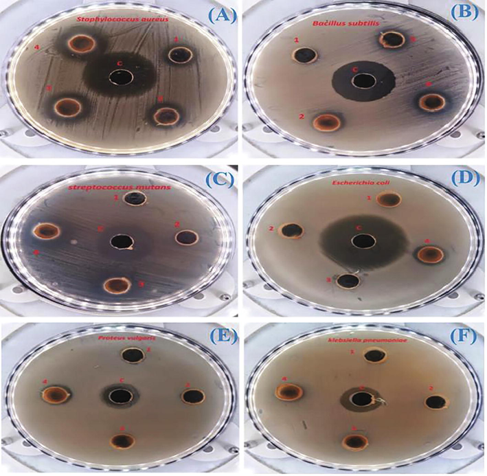 Antimicrobial activity of synthesized Au-NPs against gram positive and negative organisms: (A) Bacillus substillis, (B) Micrococcus luetus, (C) Staphylococcus aureus, (D) Streptococcus mutants, (E) E. coli, and (F) Proteus vulgarius (Thangamani and Bhuvaneshwari, 2019).