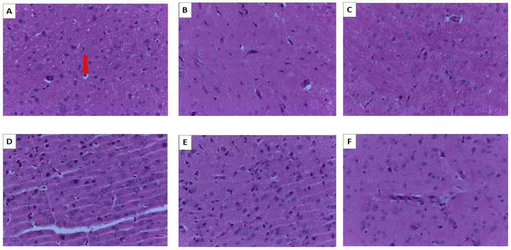 Histology of the brain. A (Normal control), B (250 mg/kg bw), C (500 mg/kg bw), D (1000 mg/kg bw), E (2000 mg/kg bw) and F (3000 mg/kg bw). Red arrow-oligodendroglia (magnification 40×).