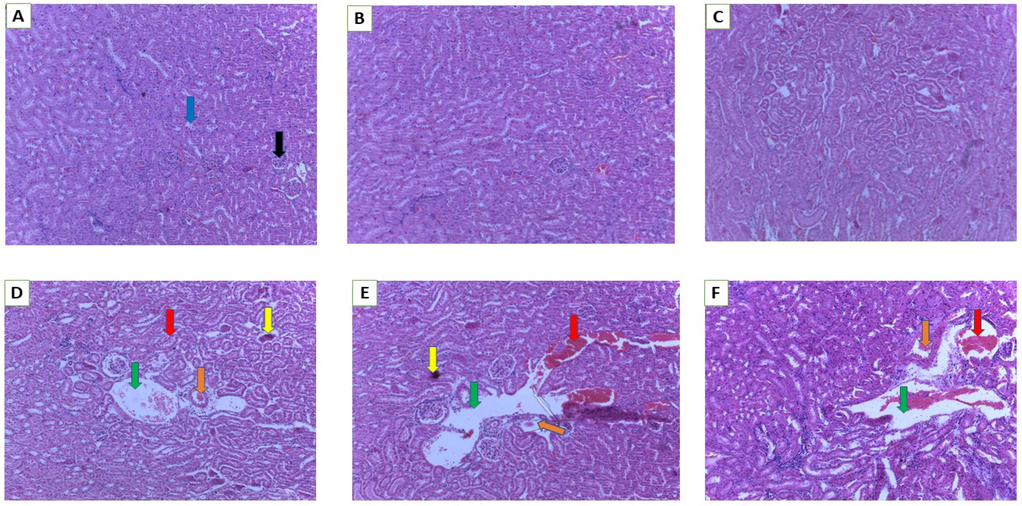 Histology of kidney. A (Normal control), B (250 mg/kg bw), C (500 mg/kg bw), D (1000 mg/kg bw), E (2000 mg/kg bw) and F (3000 mg/kg bw). Blue arrow- distal convoluted tubules, black arrow -glomerulus, green arrow-dilated tubules, orange arrow- focal degeneration, yellow arrow-apoptosis, red arrow-renal lesions/tissue haemorrhages (magnification 10×).