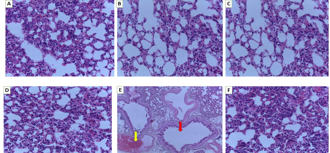 Histology of lung. A (Normal control), B (250 mg/kg bw), C (500 mg/kg bw), D (1000 mg/kg bw), E (2000 mg/kg bw) and F (3000 mg/kg bw). Red arrow-lung showing extensive emphysema and focal fibrosis of the alveoli with ruptured alveolar walls, yellow arrow-haemorrhage with degeneration of alveoli (magnification 40×).