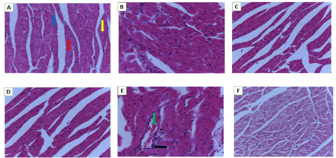 Histology of heart. A (Normal control), B (250 mg/kg bw), C (500 mg/kg bw), D (1000 mg/kg bw), E (2000 mg/kg bw) and F (3000 mg/kg bw). Blue arrow- nuclei of myocytes, yellow arrow-muscle fibre, red arrow-intercalated disc, black arrow -aggregation, green arrow-blood vessel (magnification 40×).