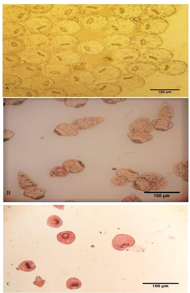 Live (control) unstained protoscolices (A), live (control) protoscolices after staining with 0.1 percent eosin (B), dead protoscolices after treatment with ACCV and staining with 0.1 percent eosin (C). Scale-bar = 100 µm.