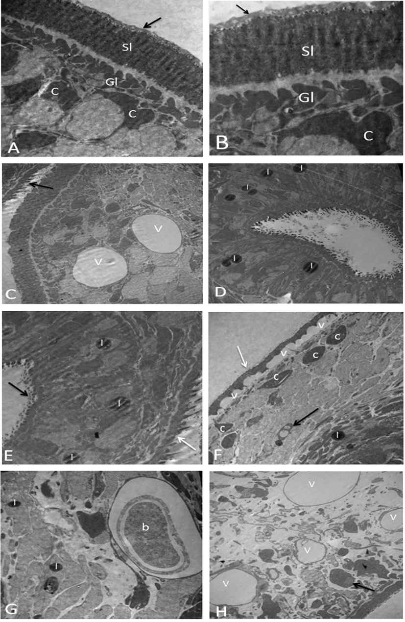 Protoscolices by TEM. (A-B) Normal protoscolices with distinctive features like; Gl (Germinal layer), which contains numerous cell forms, such as parenchymal cells (c), a syncytial layer of tegument (Sl), and PAS-positive material (arrow) (A) (X5810) and (B) (X10000). (C-D) Protoscolices incubated with 50 µg/ml ACCV (C) showed start loss of PAS-positive material (arrow) and vacuolation of cytoplasm (v) (X2900). (D) showed the presence of lipid droplets (l) (X3600). (E-H) Protoscolices incubated with 100 µg/ml ACCV (E) showed start loss of PAS-positive material (white arrow), shedding of microtriches (black arrow), and the presence of lipid droplets (l) (X4810). (F) showed vacuolation of distal cytoplasm (v), condensed cytoplasm of parenchymal cells (c), apoptotic bodies (black arrow), lipid droplets (l), and complete loss of PAS-positive material and microtriches (white arrow) (X3600). (G) showed residual lamellar bodies (b) and the presence of lipid droplets (l) (X4810). (H) showed cytoplasm vacuolation (v), The nuclear membrane of a parenchyma cell has a crescent-shaped heterochromatin mass (arrow), and extensive damage of the internal tissue (X2900).