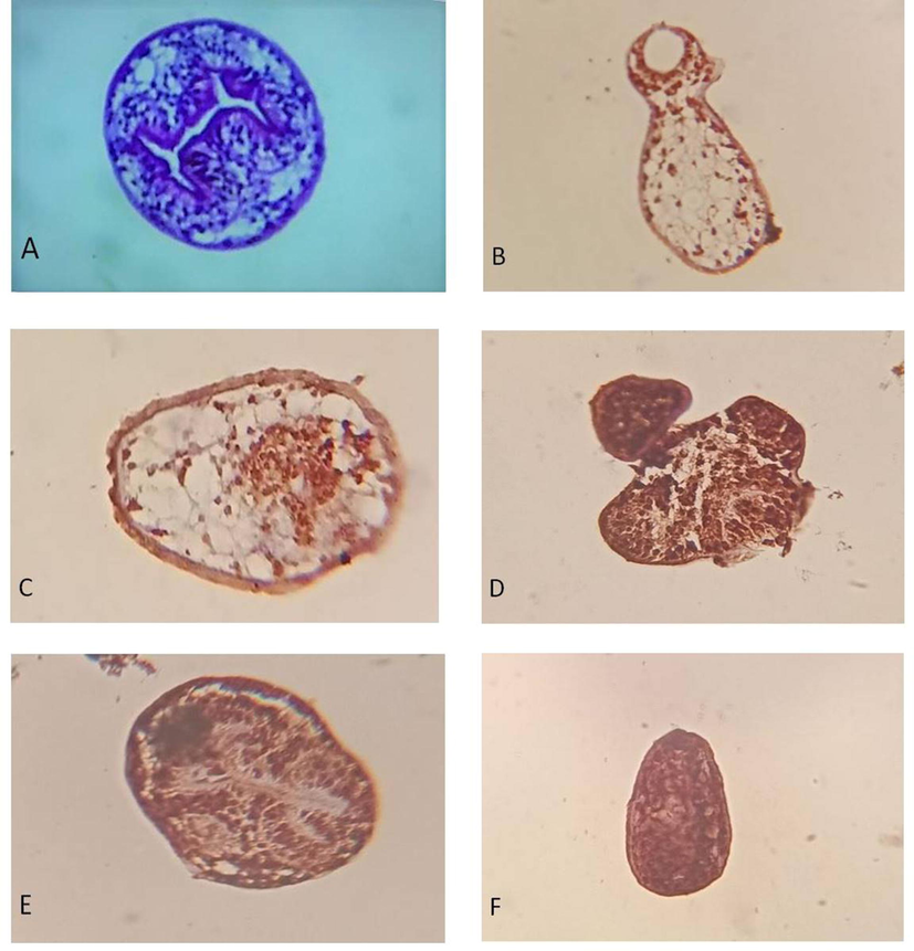 Caspase-3 expression in protoscolices using immunohistochemistry. (A) control protoscolices; (B-C) Protoscolices incubated with 50 µg/ml ACCV for 4 h, the results showed few spots stained brownish; (D-F) Protoscolices incubated with 100 µg/ml ACCV for 4 h, the results showed whole protoscolices stained brown (x400).