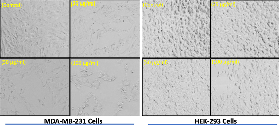 Morphological study of apoptosis in MDA-MB-231 and HEK-293 cells induced by APPeE. Images were acquired by phase contrast light microscopy (Olympus, CKX41, Japan).