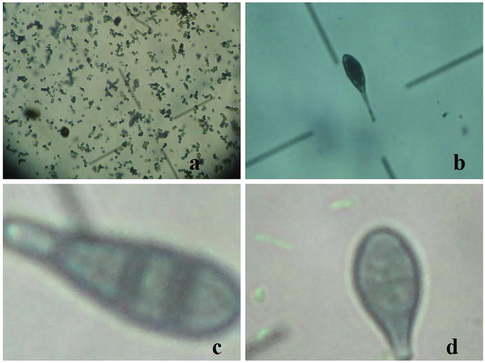 Different pathogens detected during the study, Aspergillus spp. (a), Alternaria alternata (b), Alternaria tenuis (c), and Alternaria sesame (d).