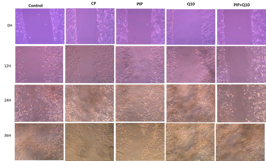 Shows HuH-7 cells migration in wound-healing assays. cells were treated with CP, PIP, CoQ-10, PIP + CoQ-10 for 48 hr and images were captured at 0 and 12, 24, and 36 hr.