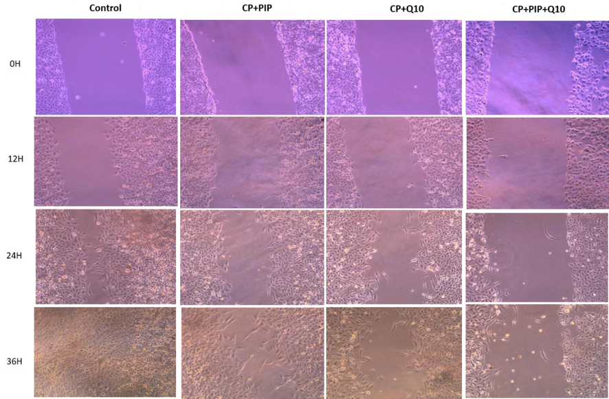 Shows HuH-7 cells migration in wound-healing assays. cells were treated with CP + PIP, CP + CoQ-10, CP + PIP + CoQ-10 for 48 hr and images were captured at 0 and 12, 24, and 36 hr.