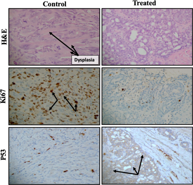 Histopathological and immunohistochemical evaluation of cell proliferation and apoptotic markers following treatment with aqueous extract (300 mg/kg body weight) in the rat model of breast cancer. Representative treated and untreated rats were used for the evaluation. Hematoxylin and eosin staining was used for the histopathological examination, whereas antibodies for Ki67 and p53 were used for immunohistochemical staining. Magnification 400×.