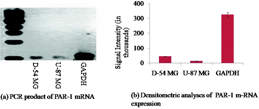 (a) Represents the RT-PCR analysis of the PAR1 mRNA receptor. PCR is performed using specific sets of protease receptor and GAPDH. (b) Densitometric analysis of protease receptor m-RNA expression in D54 and U87 cell lines. m-RNA was genetically modified for GAPDH and expressed as descriptive ± SEM.