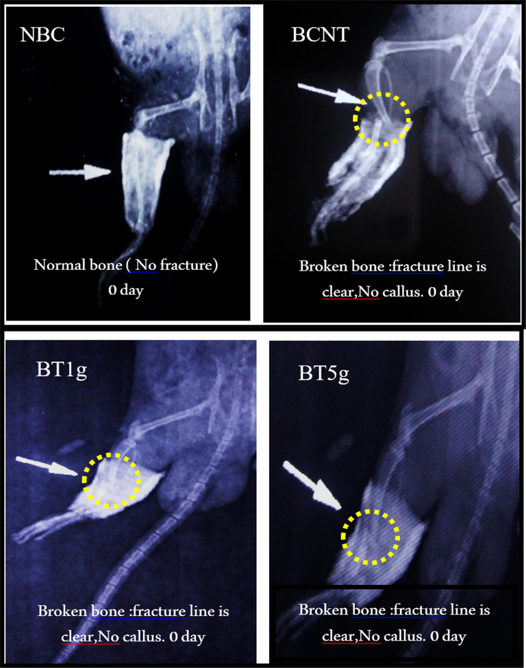 X-ray photos at initial day of tibial fracture induced in male albino rats. NBC = Non-Broken control; BCNT = Broken control-non treated; BT1g = Broken- treated with1g. BT5g = Broken- treated with 5 g; Yellow circle = the zone of induced fracture; White arrow indicate the fracture line.