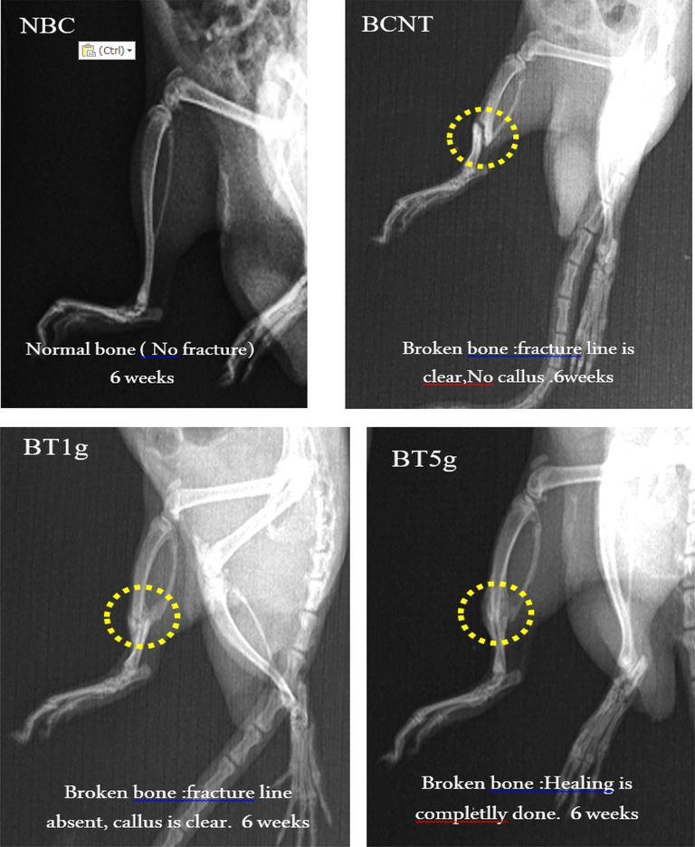 X-ray photo after 6 weeks of tibial fracture induced in male albino rats. NBC = Non-Broken control; BCNT = Broken control-non treated; BT1g = Broken- treated with1g. BT5g = Broken- treated with 5 g; Yellow circle = the zone of induced fracture; White arrow indicate the fracture line.